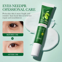 20g Olive Eye Cream - Firming Eye Cream For Dark Circles & Wrinkles