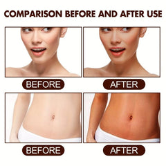 Natural Dark Brown Skin Self-Tanning Cream with Moisturizing Bronzing Effect