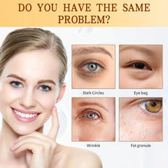 Golden Eye Essence 25g Reduce Dark Circles Wrinkle Removing Essence