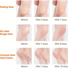 1pair Multicolor Heel Silicone Cover Moisturizing Foot Cover