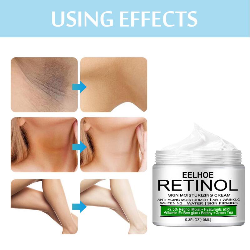 Retinol Body Cream for Skin Pigmentation 30ml