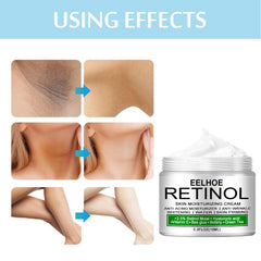 Retinol Body Cream for Skin Pigmentation 30ml