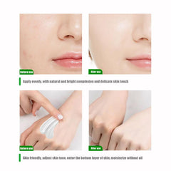 Retinol Body Cream for Skin Pigmentation 30ml
