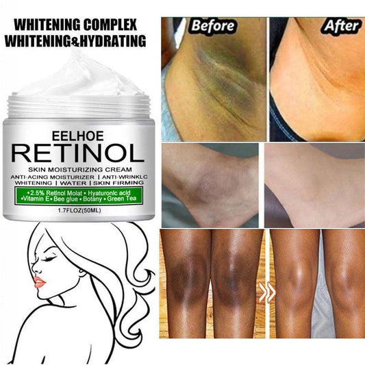 Retinol Body Cream for Skin Pigmentation 30ml