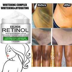 Retinol Body Cream for Skin Pigmentation 30ml