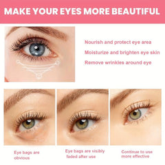 Rose Eye Patch Eye Stickers Fight Dark Circles & Wrinkles