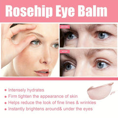 Rose Eye Patch Eye Stickers Fight Dark Circles & Wrinkles