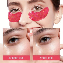 5 Pairs Under Eye Patches - Dark Circle & Puffiness Reducing Hydrogel Eye Masks