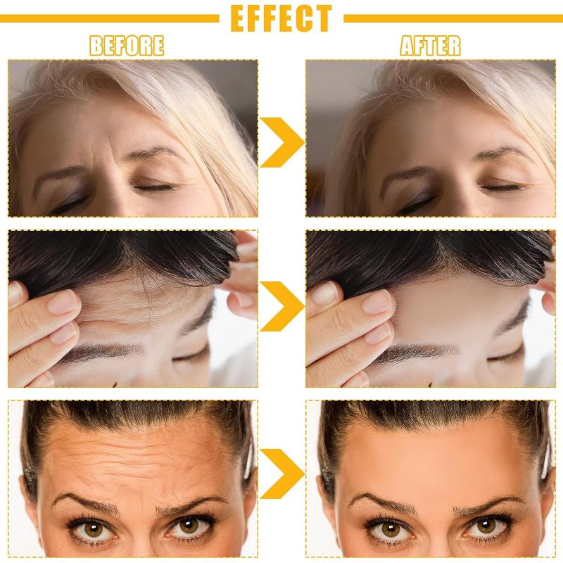 10Pcs Forehead Wrinkle Patches with Hydrolyzed Collagen - Reduce Fine Wrinkles