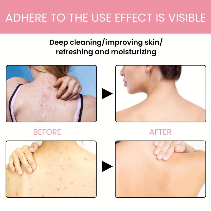 Fruit Acid Body Lotion for Women - Summer Hydration with Long Lasting Fragrance