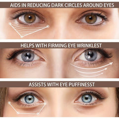 Squalane Eye Cream - Dark Circles & Puffiness - Night Under Eye Cream