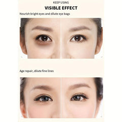 6ml Under Eye Patches Dark Circles Puffiness Eye Bags Hydrating Brightening