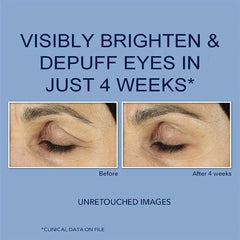 Dark Circle & Puffiness Eye Cream