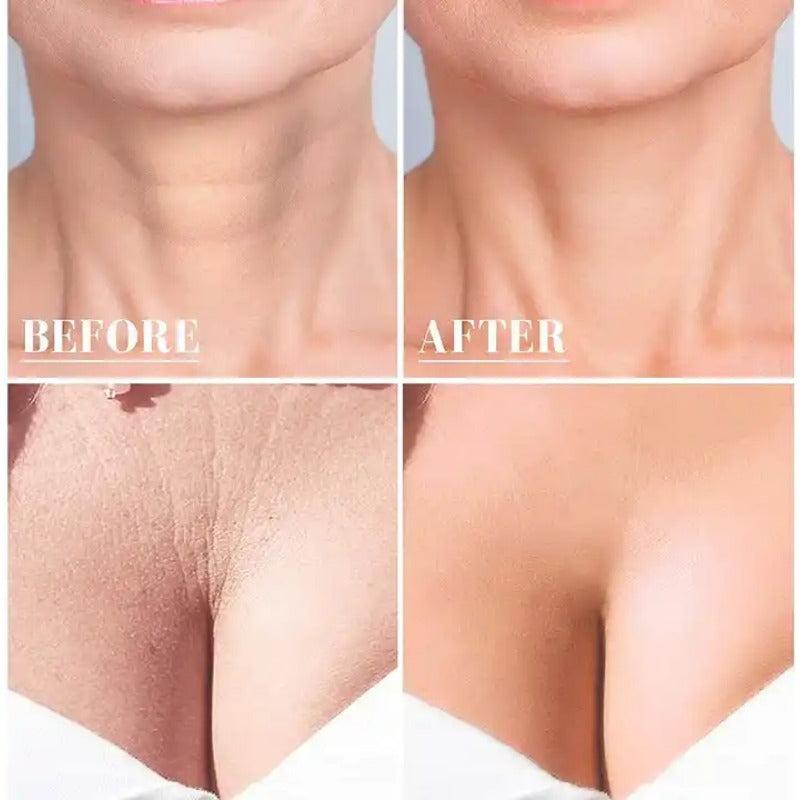 Silicone Wrinkle Diminishing Neck Pads - Skin Care
