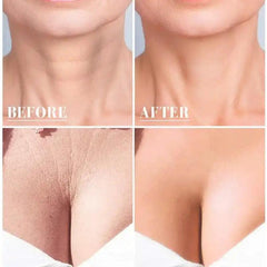 Silicone Wrinkle Diminishing Neck Pads - Skin Care