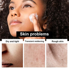 Mother Cream 150g Hydrating Therapeutic Intensive Moisturizer