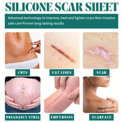 Concealer Tattoo Cover Invisible Stickers Waterproof