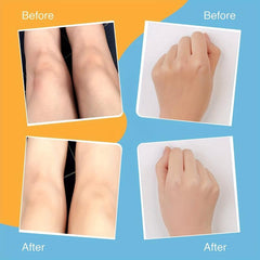 Dark Spot Corrector Underarm Cream Armpit Elbows Knees Neck Private Area 50g