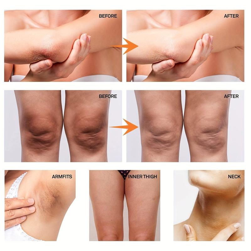 Dark Spot Corrector Underarm Cream Armpit Elbows Knees Neck Private Area 50g