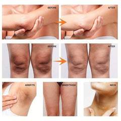 Dark Spot Corrector Underarm Cream Armpit Elbows Knees Neck Private Area 50g