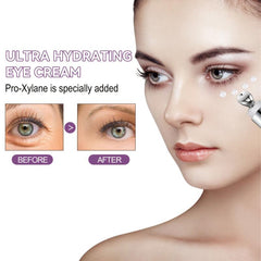 Moisturizing Eye Cream 15g for Dark Circles & Eye Bags