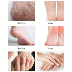 Skin Moisturizing Cream 50g Prevents Dryness and Cracking