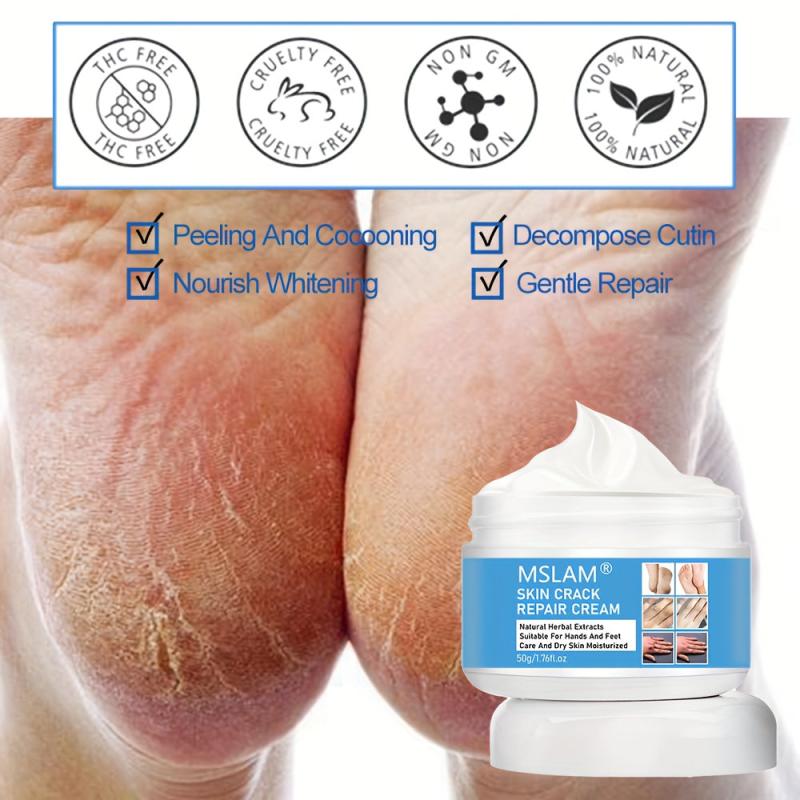 Skin Moisturizing Cream 50g Prevents Dryness and Cracking