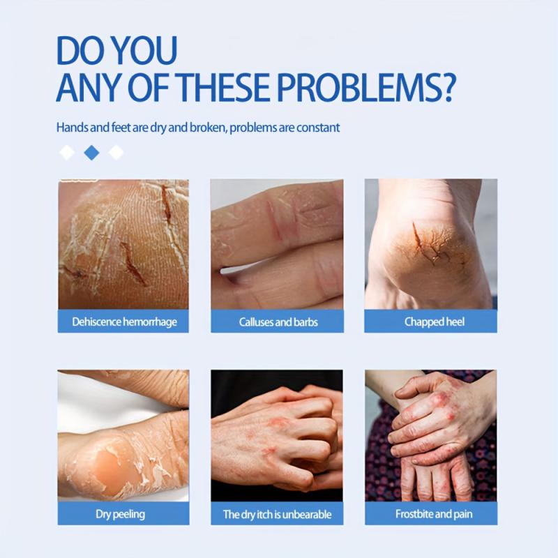 Skin Moisturizing Cream 50g Prevents Dryness and Cracking