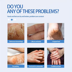 Skin Moisturizing Cream 50g Prevents Dryness and Cracking