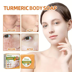 Turmeric Spots Cleansing Soap Skin Removal and Rejuvenation
