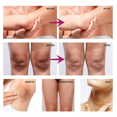 50ml Underarm Rejuvenating Cream Repair Elbow Knee Joint Brighten Skin Tone