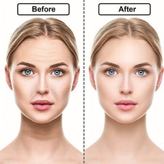 18 Pcs Wrinkle Patches Chest Wrinkle Pads Facial Wrinkle Remover Strips