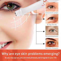Anti Aging Eye Cream - Reduce Wrinkles and Dark Circles