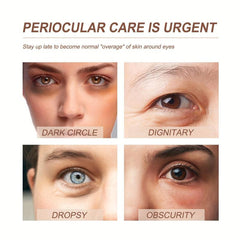 Eye Essence Fade Dark Circles Improve Elasticity Eye Care Essence