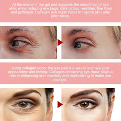 Pink Rose Eye Mask Reduces Fine Lines Dark Circles Moisturizes Skin