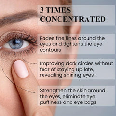 Retinol & Vitamin C Eye Cream for Dark Circles & Puffiness