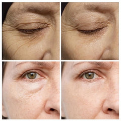 Anti-Aging Eye Cream for Dark Circles and Wrinkles
