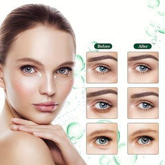 Moisturizing Eye Patches for Dark Circles Puffy Eyes