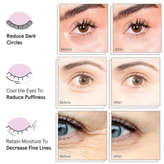 Under Eye Patches 12 Pairs Amino Acid & Collagen Under Eye Mask