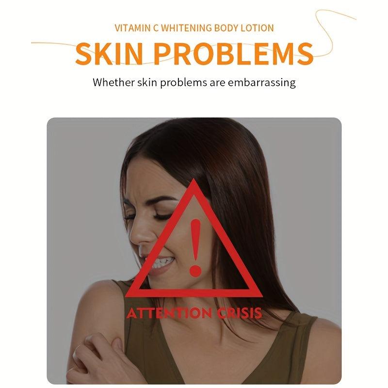 Hydrating Vitamin C Body Lotion for Dry Skin