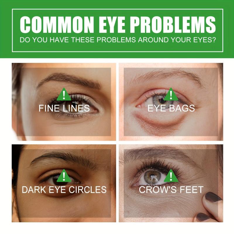 30ml Eye Care Essence - Smooth Fine Lines & Dark Circles, Improve Dullness