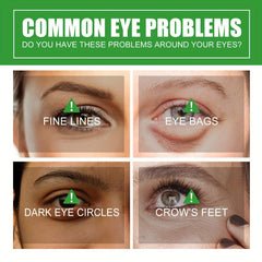 30ml Eye Care Essence - Smooth Fine Lines & Dark Circles, Improve Dullness