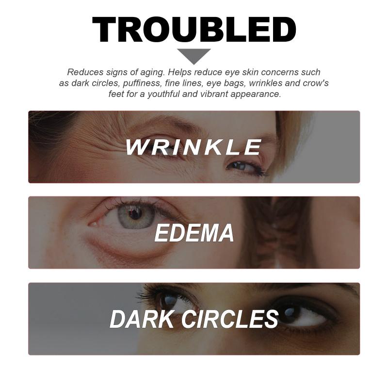 Niacinamide Eye Serum Dark Circles Wrinkle Cream Puffiness Undereye