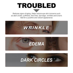Niacinamide Eye Serum Dark Circles Wrinkle Cream Puffiness Undereye