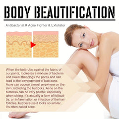 100ml Hip Care Cream, Relieves Rough Itching Acne on Buttocks, Moisturizes Skin