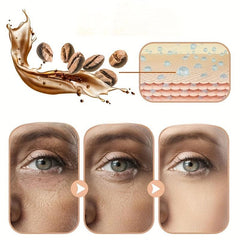 Chesnut Eye Cream 15g Fat & Milk Spot Removal Repair & Revitalize Eye Skin