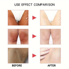 2pcs 60ml Body Radiant Cream for Intimate Areas & Dark Spots