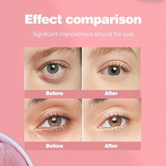 Strawberry Under Eye Patches Brighten Dark Circles Puffiness Hydrating