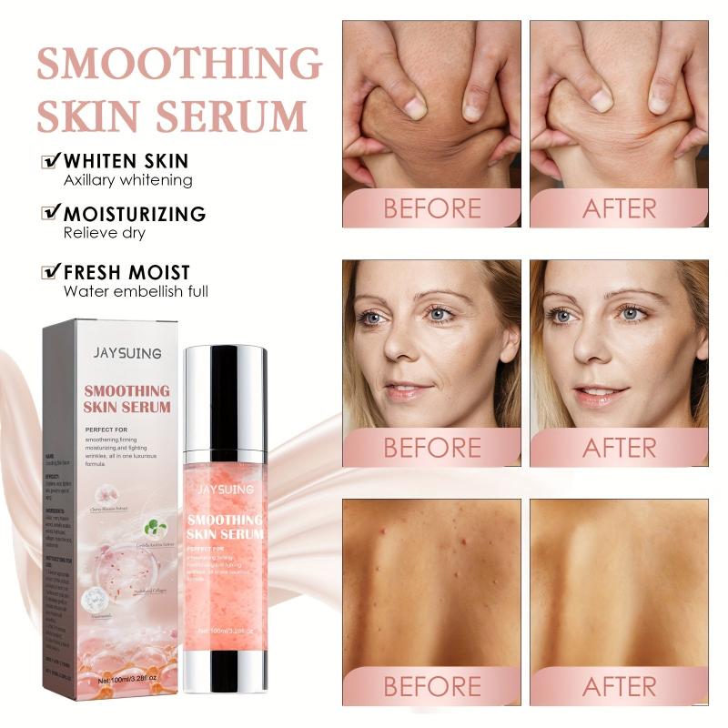 100ml Smoothing Body Serum Moisturize Skin Prevent Dryness Repair Chicken Skin