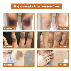 Skin Beautifying Essential Arm Curve Darkening Exfoliating Essence